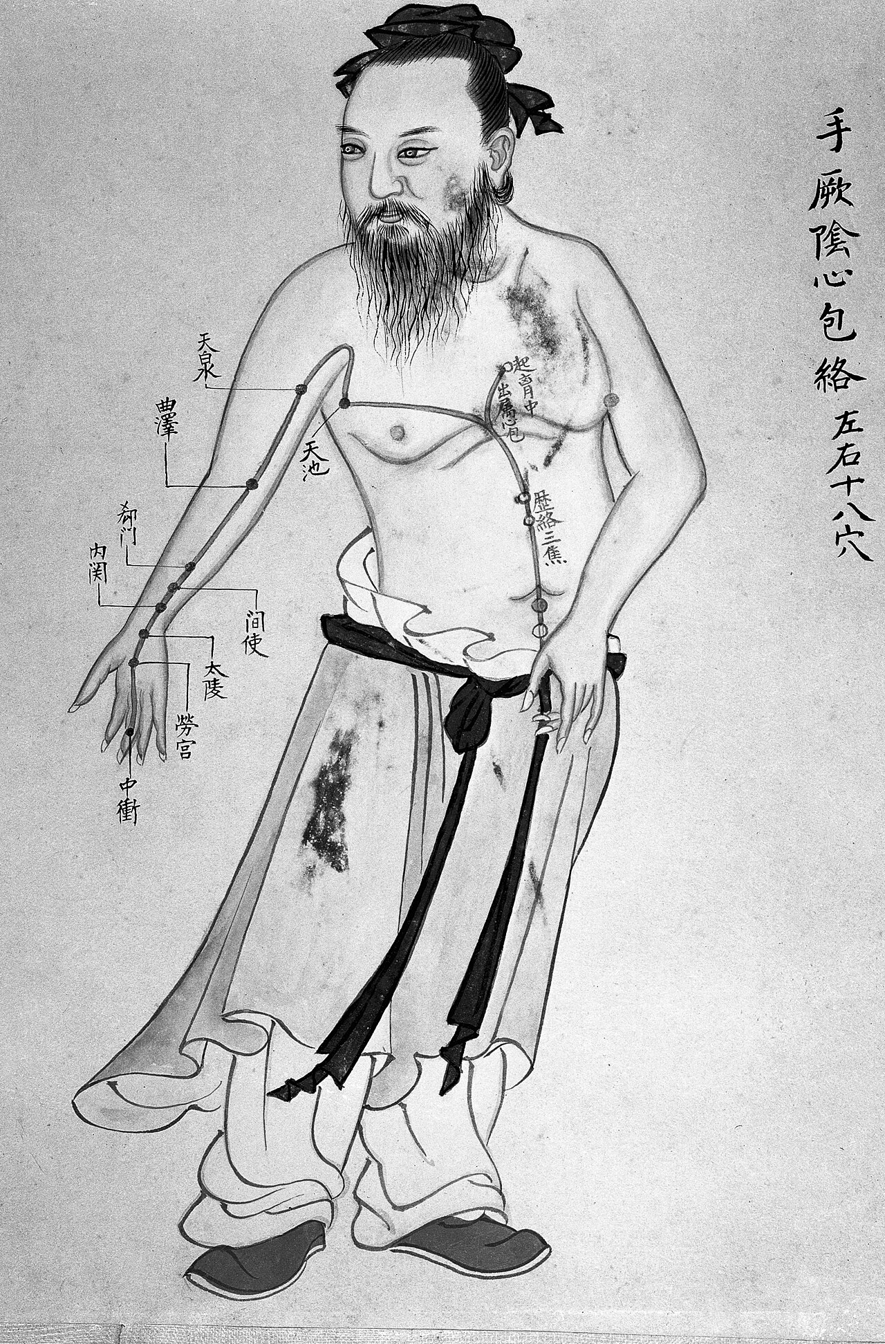 Planche d'acupuncture chinoise du XVIIIᵉ siècle